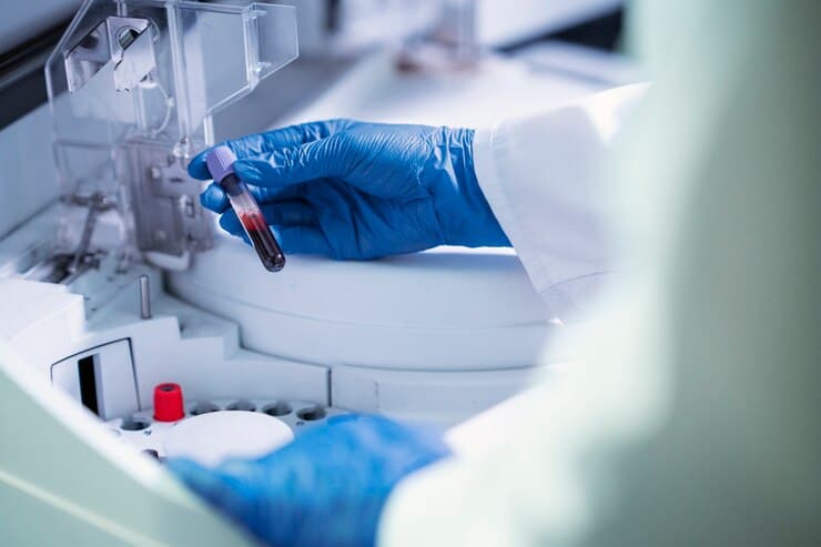 CE IVDR Regulatory Compliance